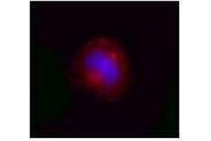 Immunofluorescence (IF) image for anti-Valosin Containing Protein (VCP) antibody (ABIN2666417) (VCP antibody)