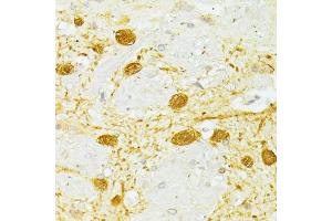 Immunohistochemistry of paraffin-embedded rat brain using PVALB antibody (ABIN6290777) at dilution of 1:100 (40x lens). (PVALB antibody)