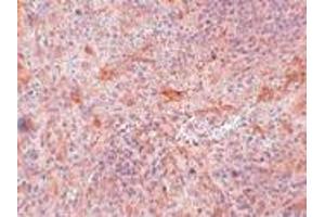 Immunohistochemistry (IHC) image for anti-TNFAIP3 Interacting Protein 3 (TNIP3) (C-Term) antibody (ABIN1030214) (TNIP3 antibody  (C-Term))