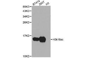 Western blot analysis of extracts of various cell lines, using Acetyl-Histone H3-K18 antibody. (Histone 3 antibody  (H3K18ac))