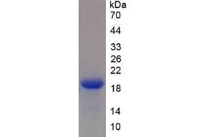 SDS-PAGE (SDS) image for Brain Natriuretic Peptide (BNP) ELISA Kit (ABIN6574089)