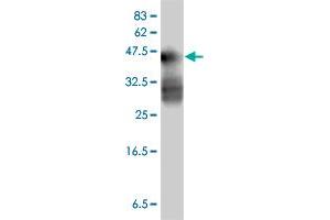 Western Blot detection against Immunogen (37 KDa) . (MAGEA12 antibody  (AA 70-168))