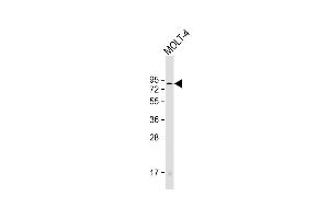 Anti-HRD1 Antibody  at 1:2000 dilution + MOLT-4 whole cell lysate Lysates/proteins at 20 μg per lane. (SYVN1 antibody  (C-Term))