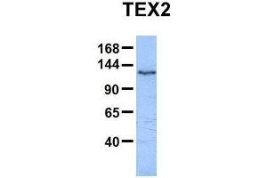 Host:  Rabbit  Target Name:  TEX2  Sample Type:  Human HepG2  Antibody Dilution:  1. (TEX2 antibody  (N-Term))