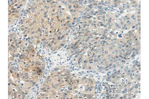 Immunohistochemistry (IHC) image for anti-Thromboxane A2 Receptor (TBXA2R) antibody (ABIN5957723) (TBXA2R antibody)