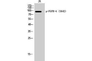 Western Blot analysis of Jurkat cells with Phospho-FGFR4 (Tyr642) Polyclonal Antibody (FGFR4 antibody  (pTyr642))