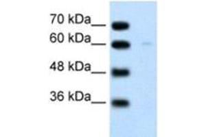 Western Blotting (WB) image for anti-Regulator of G-Protein Signaling 4 (RGS4) antibody (ABIN2460183) (RGS4 antibody)