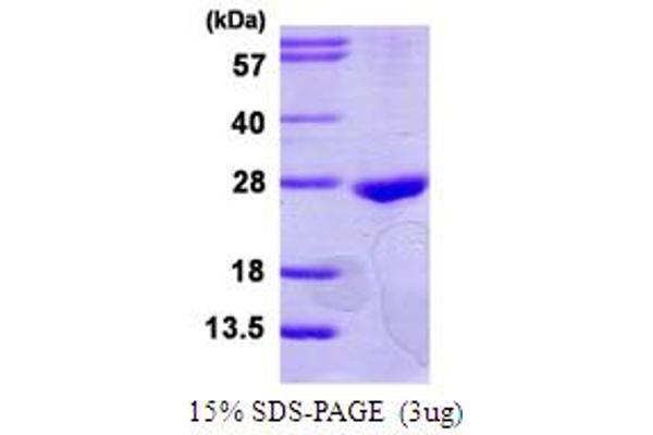 RAB22A Protein (AA 1-194) (His tag)