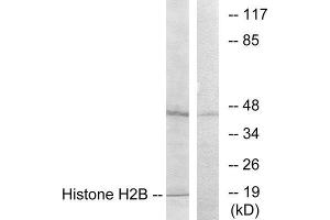 Western Blotting (WB) image for anti-Histone H2B (N-Term) antibody (ABIN1849874) (Histone H2B antibody  (N-Term))