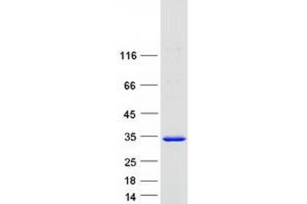 PSMA3 Protein (Transcript Variant 1) (Myc-DYKDDDDK Tag)