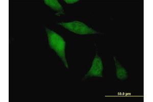 Immunofluorescence of purified MaxPab antibody to AGGF1 on HeLa cell. (AGGF1 antibody  (AA 1-714))