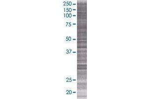 MSRB3 transfected lysate. (MSRB3 293T Cell Transient Overexpression Lysate(Denatured))