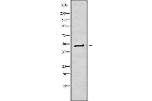 Western blot analysis of K1H1 using COS7 whole cell lysates (Keratin 31 antibody)