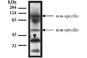 Western blot analysis using TUP1 antibody on recombinant TUP1 protein (amino acids 1-200) expressed in Mav108 cells. (HIRA antibody)