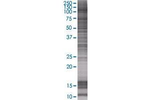 STAT6 transfected lysate. (STAT6 293T Cell Transient Overexpression Lysate(Denatured))