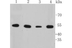 Lane 1: A549 Cell lysates, Lane 2: HepG2 Cell lysates, Lane 3: SK-BR-3 Cell lysates, Lane 4: SW1990 cell lysates, probed with Cytokeratin 7 (6E6) Monoclonal Antibody  at 1:1000 overnight at 4˚C. (Cytokeratin 7 antibody)