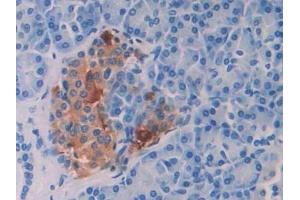 Detection of ENA78 in Human Pancreas Tissue using Polyclonal Antibody to Epithelial Neutrophil Activating Peptide 78 (ENA78) (CXCL5 antibody  (AA 38-114))