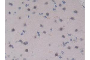 DAB staining on IHC-P; Samples: Rat Brain Tissue (IL17RA antibody  (AA 617-847))