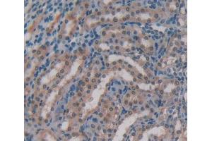 Used in DAB staining on fromalin fixed paraffin- embedded kidney tissue (GBP4 antibody  (AA 1-304))