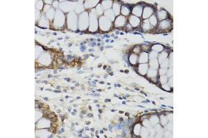 Immunohistochemistry of paraffin-embedded human rectum using GHRL antibody (ABIN6292644) at dilution of 1:100 (40x lens). (Ghrelin antibody)