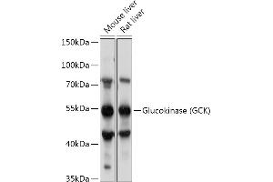 Western blot analysis of extracts of various cell lines, using Glucokinase (GCK) antibody (ABIN7267397) at 1:1000 dilution. (GCK antibody  (AA 250-465))