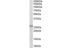Western Blotting (WB) image for anti-Glutathione S-Transferase mu 1 (GSTM1) (C-Term) antibody (ABIN2465796) (GSTM1 antibody  (C-Term))