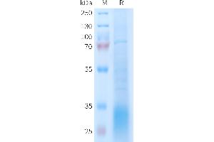 GLP2R Protein (AA 1-173) (His tag)