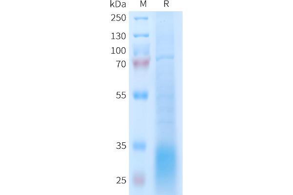 GLP2R Protein (AA 1-173) (His tag)