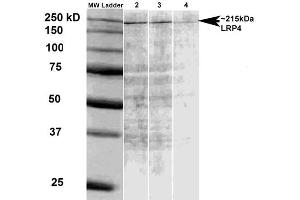 Western Blot analysis of Rat brain membrane lysate showing detection of LRP4 protein using Mouse Anti-LRP4 Monoclonal Antibody, Clone S207-27 . (LRP4 antibody  (AA 26-350) (PerCP))