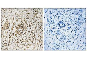 Immunohistochemistry (IHC) image for anti-Calcium And Integrin Binding Family Member 2 (CIB2) (Internal Region) antibody (ABIN1849038) (CIB2 antibody  (Internal Region))