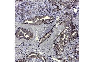 Immunohistochemistry (IHC) image for anti-CD44v5 antibody (ABIN2480453) (CD44v5 antibody)