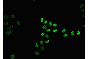 Immunofluorescence staining of Hela cells (treated with 30mM sodium butyrate for 4h) with ibHU at 1:15, counter-stained with DAPI. (HIST1H4A antibody)
