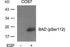 Western blot analysis of extracts from cos7 cells untreated or treated with EGF using BAD(Phospho-Ser112) Antibody (BAD antibody  (pSer112))