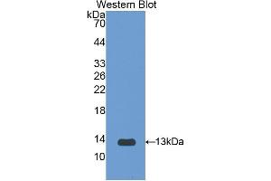 Detection of Recombinant IL1R1, Rat using Polyclonal Antibody to Interleukin 1 Receptor Type I (IL1R1) (IL1R1 antibody  (AA 119-217))