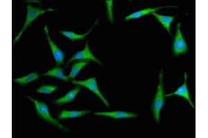 Immunofluorescence staining of Hela cells with ABIN7156645 at 1:100, counter-stained with DAPI. (MX2 antibody  (AA 548-688))