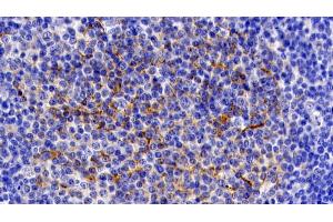 Detection of IL11Ra in Human Lymph node Tissue using Polyclonal Antibody to Interleukin 11 Receptor Alpha (IL11Ra) (IL11RA antibody  (AA 59-220))