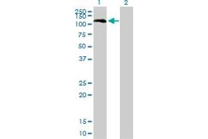 Western Blot analysis of BUB1 expression in transfected 293T cell line by BUB1 monoclonal antibody (M01), clone 4C3-4C9. (BUB1 antibody  (AA 1-1085))