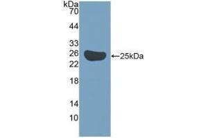 Detection of Recombinant Surv, Mouse using Polyclonal Antibody to Survivin (Surv) (Survivin antibody  (AA 1-140))