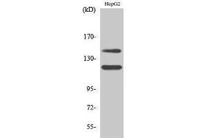 Western Blotting (WB) image for anti-Mast/stem Cell Growth Factor Receptor (KIT) (pTyr721) antibody (ABIN3181965) (KIT antibody  (pTyr721))