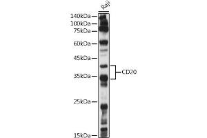 Western blot analysis of extracts of Raji cells, using CD20 antibody (ABIN7268473) at 1:1000 dilution. (CD20 antibody  (AA 208-297))
