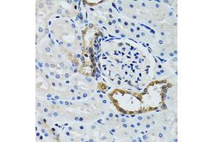 Immunohistochemistry of paraffin-embedded rat kidney using STAT3 antibody (ABIN1876697) at dilution of 1:100 (40x lens). (STAT3 antibody)