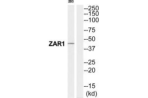 Western Blotting (WB) image for anti-Zygote Arrest 1 (ZAR1) (C-Term) antibody (ABIN1852604) (Zygote Arrest 1 antibody  (C-Term))