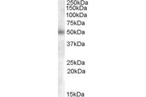 Western Blotting (WB) image for anti-Glucosaminyl (N-Acetyl) Transferase 3, Mucin Type (GCNT3) (Internal Region) antibody (ABIN2466515) (GCNT3 antibody  (Internal Region))