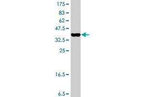 Western Blot detection against Immunogen (37. (TPT1 antibody  (AA 35-138))