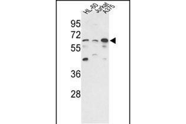 PPP3CC antibody  (N-Term)