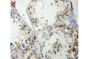 Used in DAB staining on fromalin fixed paraffin-embedded Testis tissue (RASA1 antibody  (AA 403-596))