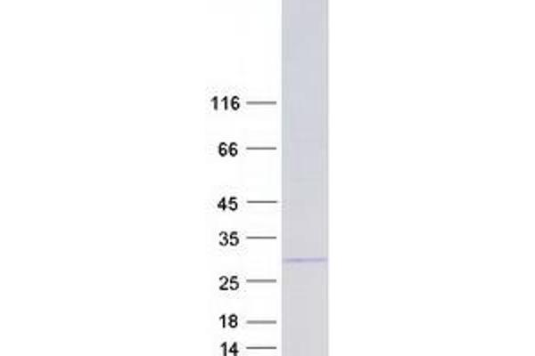 FAM3A Protein (Transcript Variant 3) (Myc-DYKDDDDK Tag)