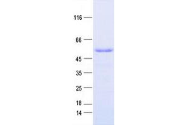 NSUN5 Protein (DYKDDDDK Tag)