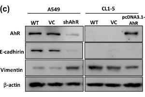 Western Blotting (WB) image for anti-Vimentin (VIM) antibody (ABIN2854814)