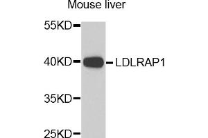 Western blot analysis of extracts of mouse liver, using LDLRAP1 antibody. (LDLRAP1 antibody)